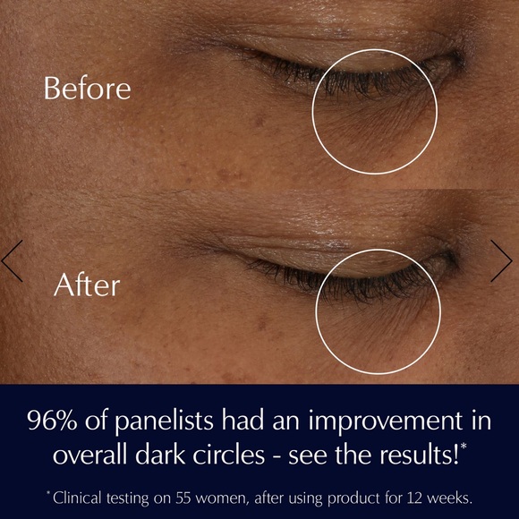 Estée Lauder Advanced Night Repair Eye Supercharged Complex - $72 RETAIL - Picture 4 of 6